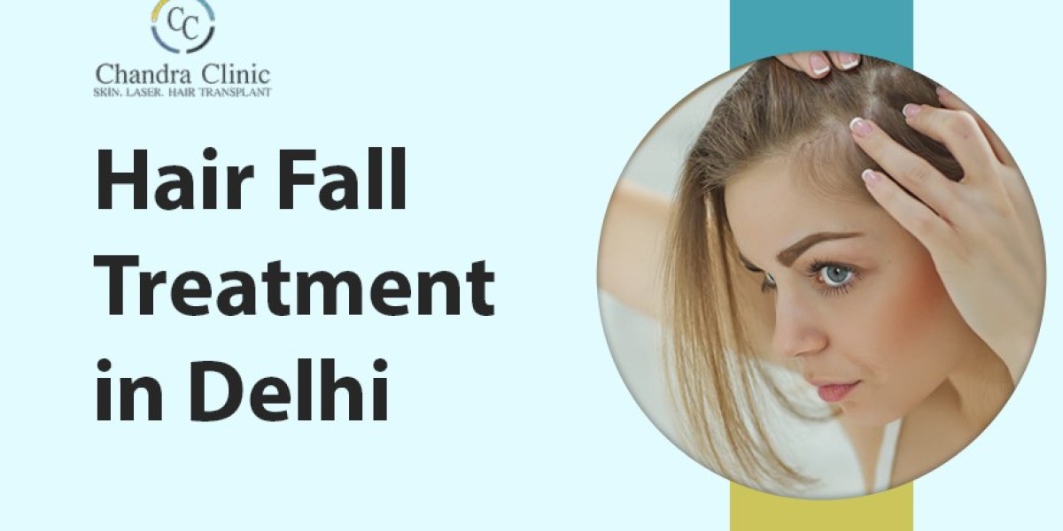 Female Hair Transplant: What You Need to Know