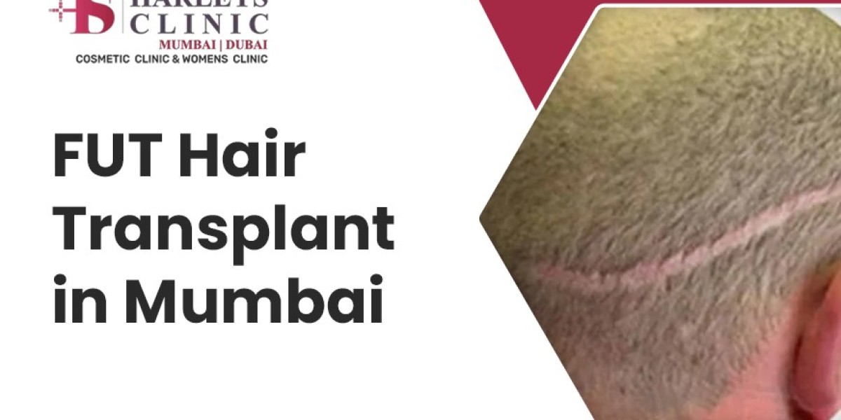 Everything You Need to Know About FUT Hair Transplants
