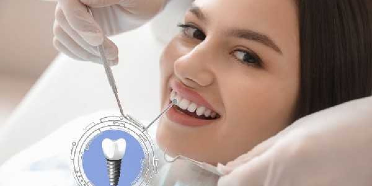 Immediate Implant Options for Smile Emergencies