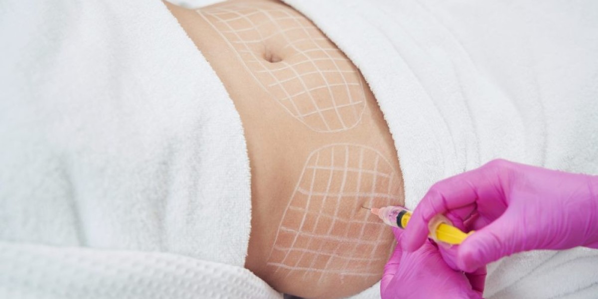 Can Lipolysis Treatment Help Reduce Thigh Fat?