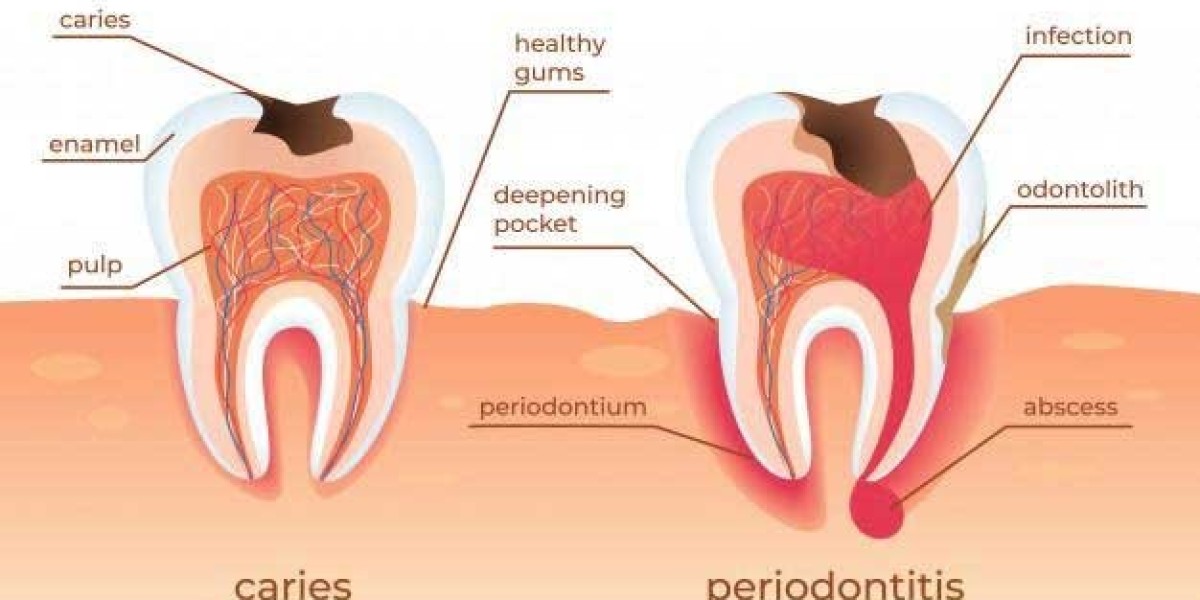 Essential Dental Care Tips for a Healthier Smile in Your City