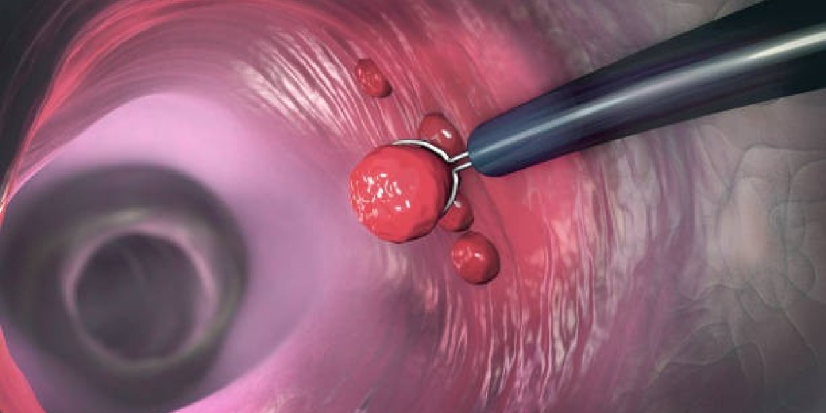 Rising Demand in the Cancer Biopsy Market: Liquid Biopsy, AI & Precision Medicine