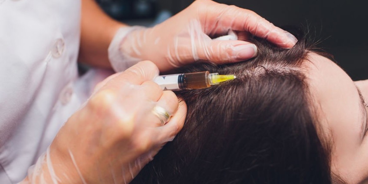 PRP Hair Therapy: Restoring Confidence Naturally