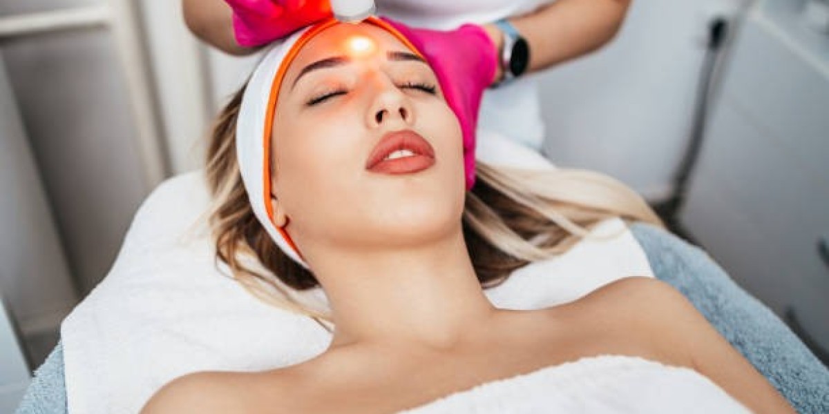 How to Prepare Your Skin Before Chemical Peels in Riyadh Treatments