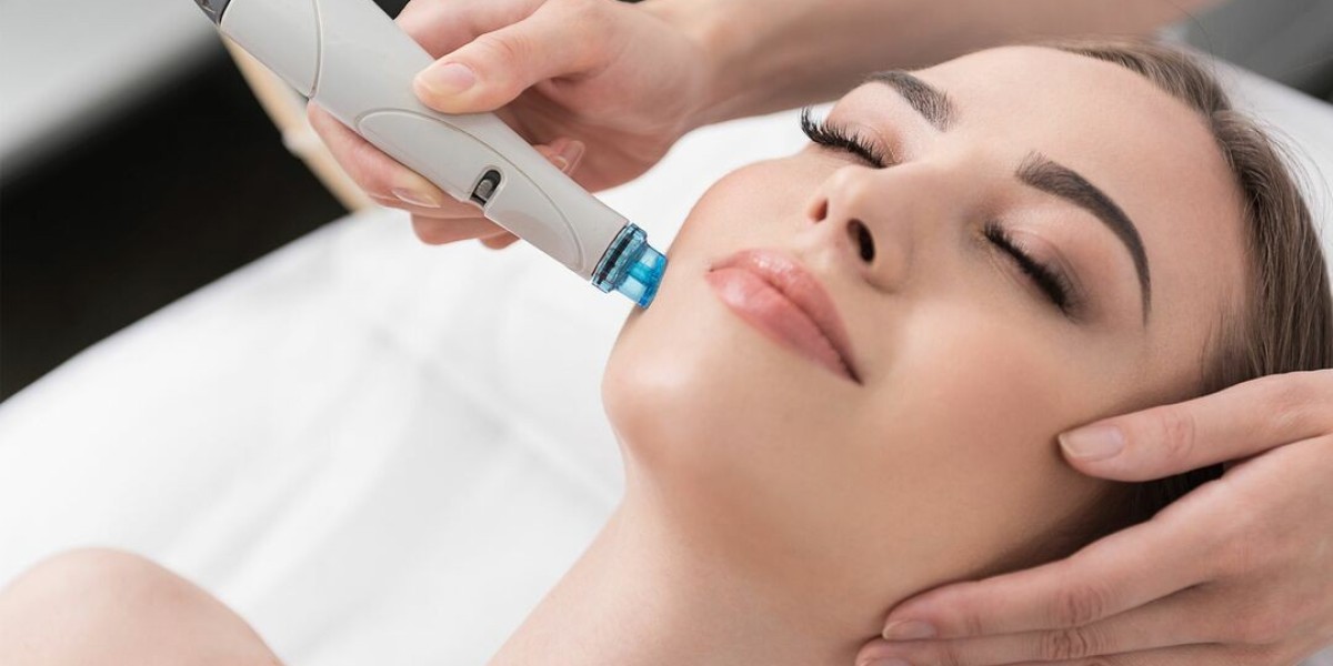 How Effective Is Hydrafacial for Thorough Skin Cleansing?