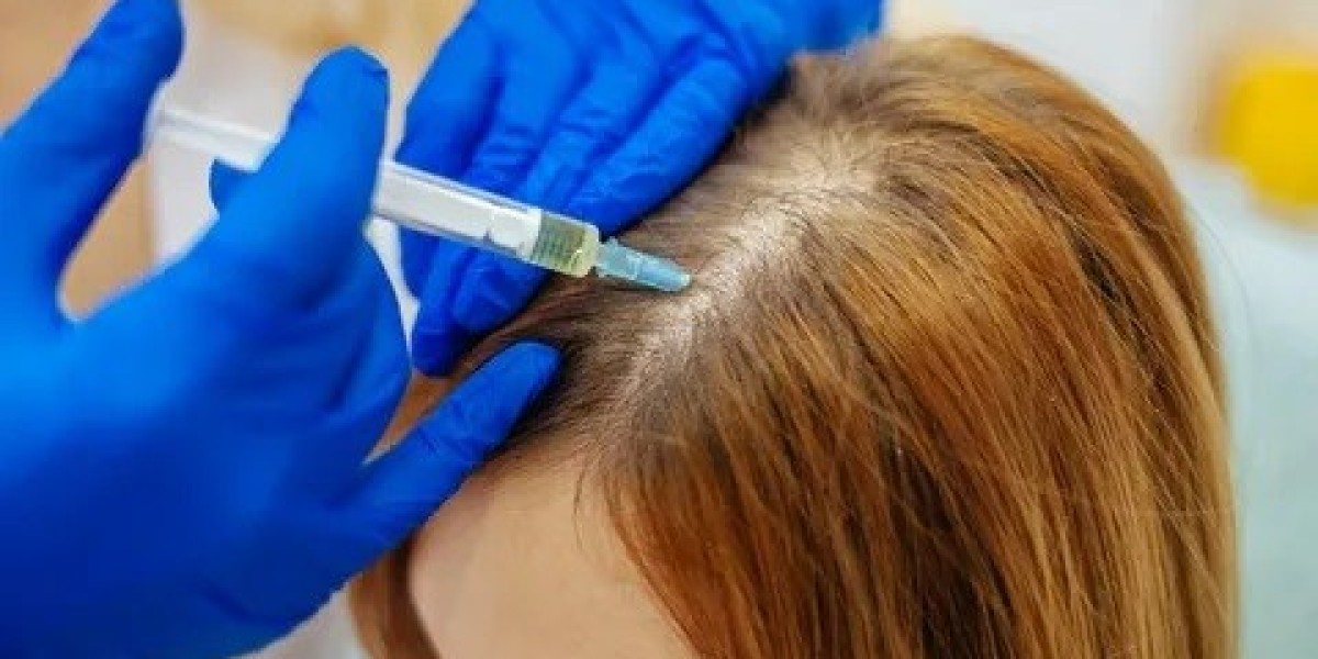 Exosomes Hair Therapy in Islamabad: Younger, Healthier Hair