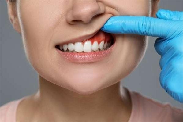 emergency dentist in Burnley