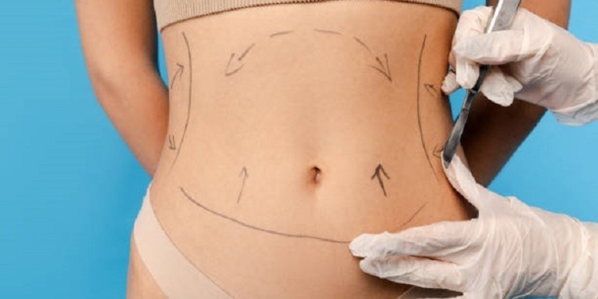 Risks and Side Effects of Liposuction in Riyadh You Should Know