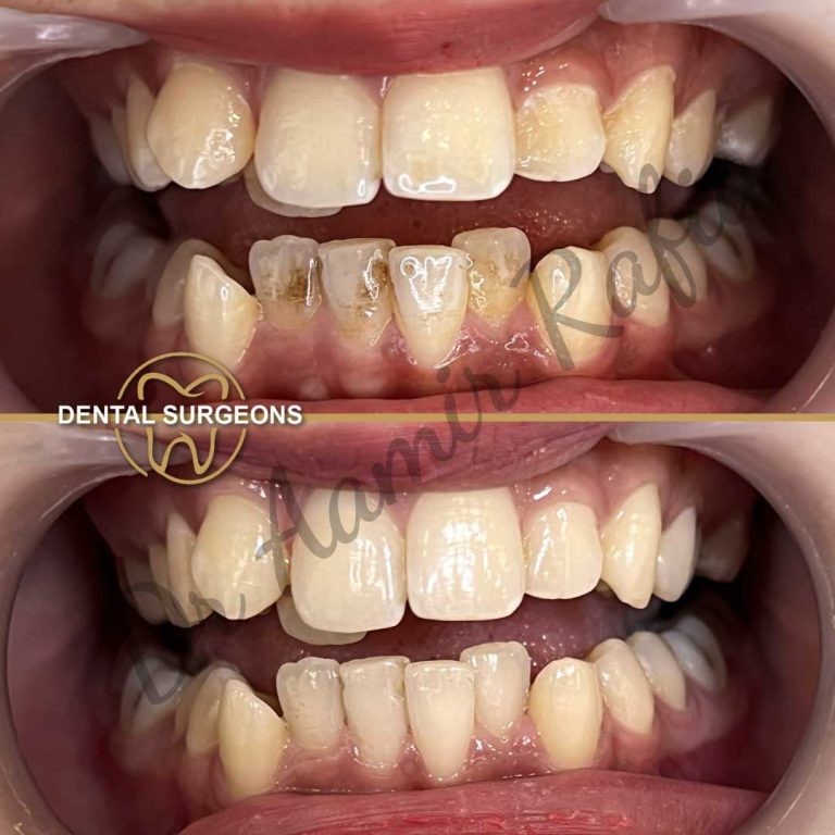 Dental Surgeons Pakistan – Expert Dental Care & Treatments