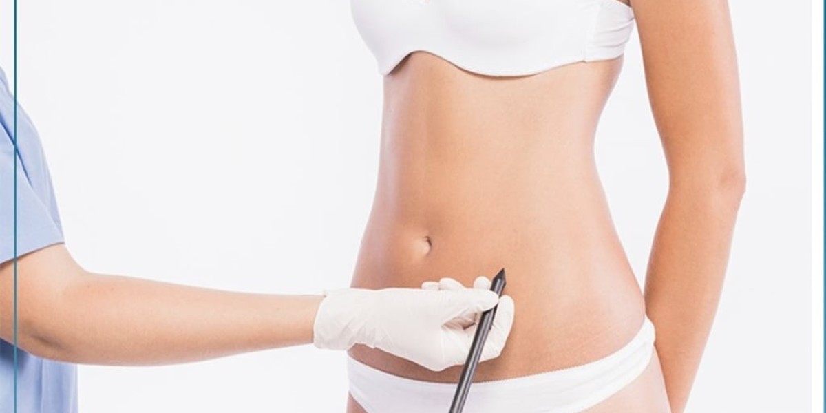 How Liposuction Contributes to More Symmetrical Looks?