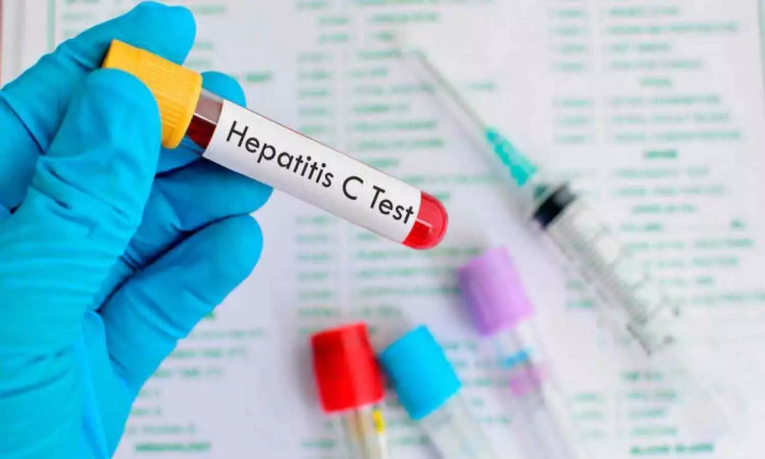 Hepatitis C Test