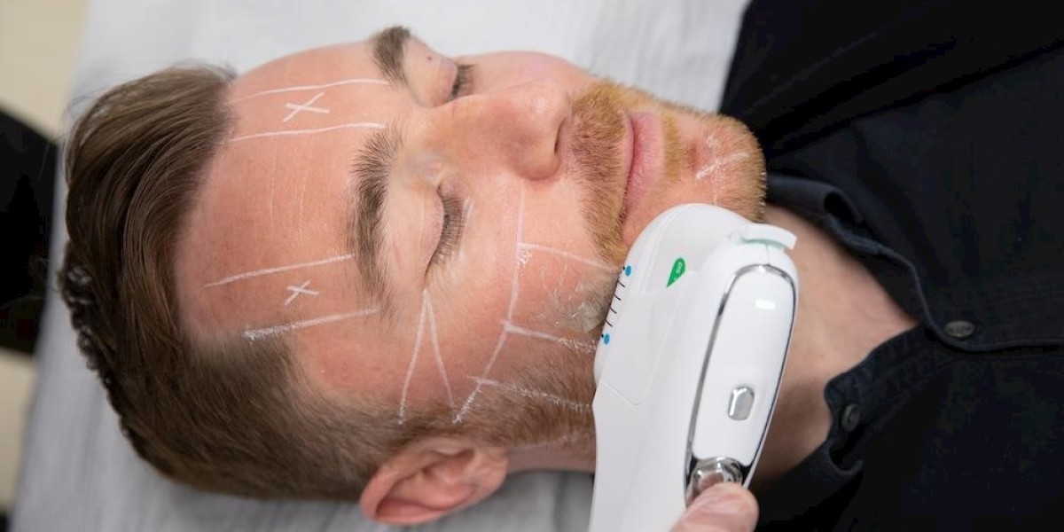 Can Men Achieve Results with HIFU Treatments Too?