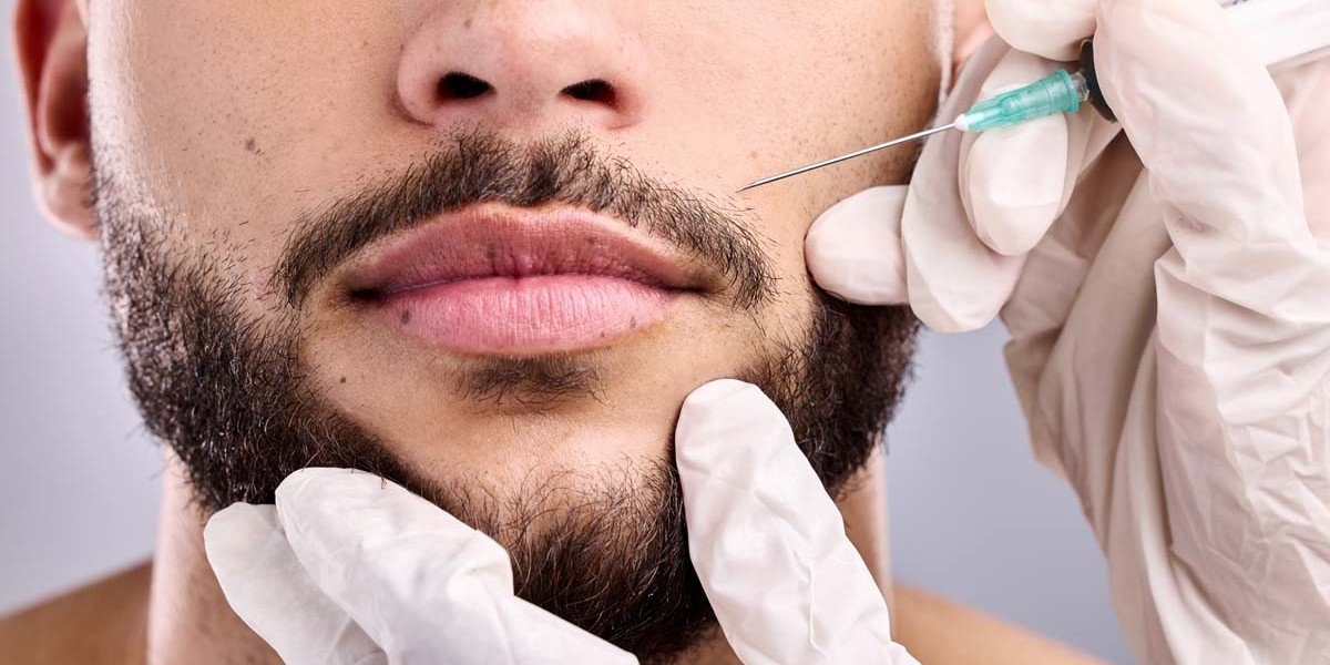 How Many Grafts Are Needed for a Mustache Hair Transplant?