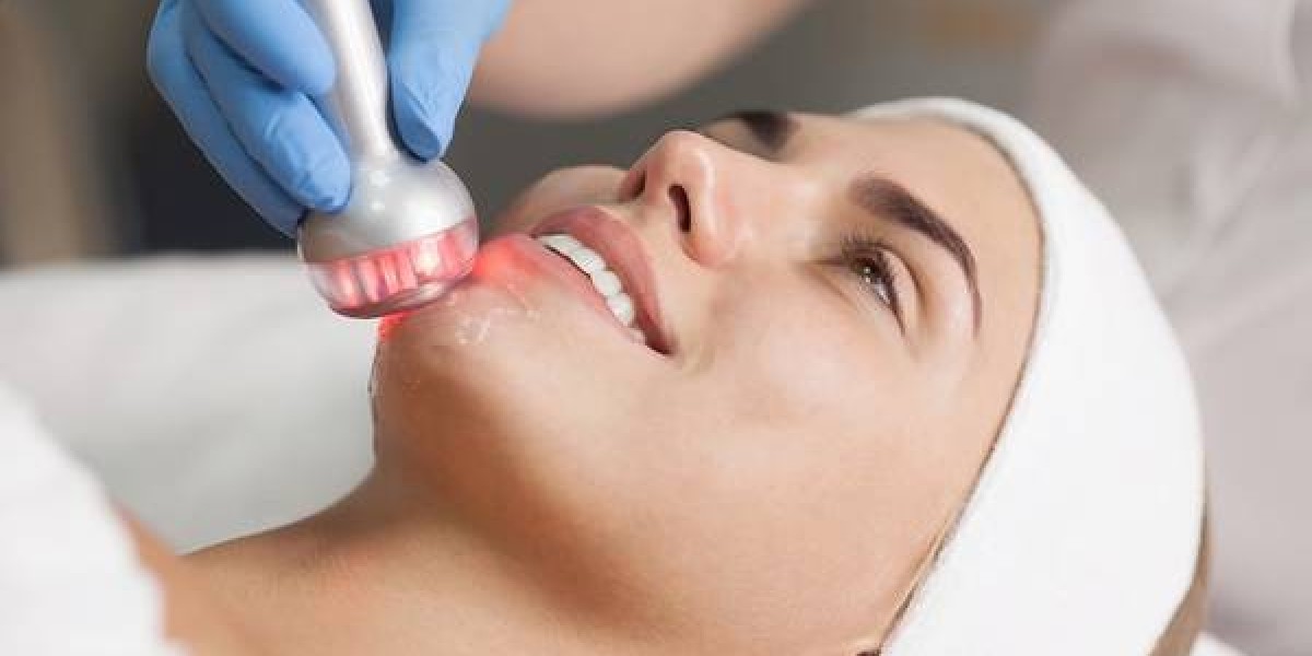 What Does Radio Frequency Skin Tightening Involve?