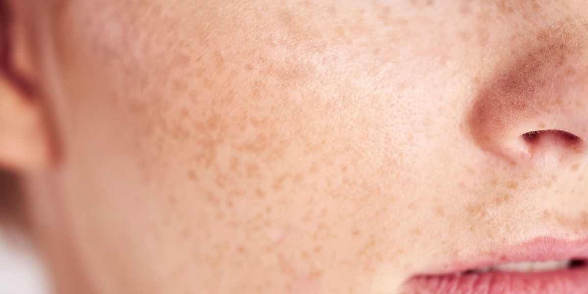 Does Dermal Pigmentation Work on All Skin Types?
