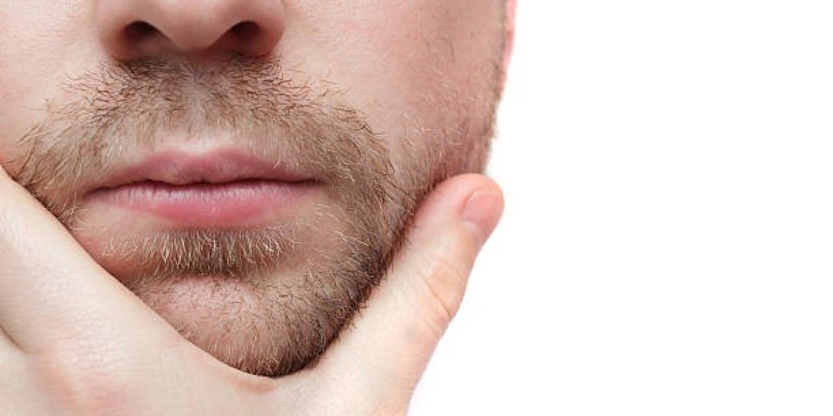 Does Beard Hair Transplant Hurt? Understanding Pain and Comfort During the Procedure