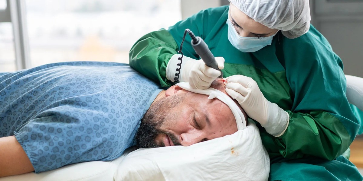 Hair Transplant Trends in Turkey: What’s New in 2025?