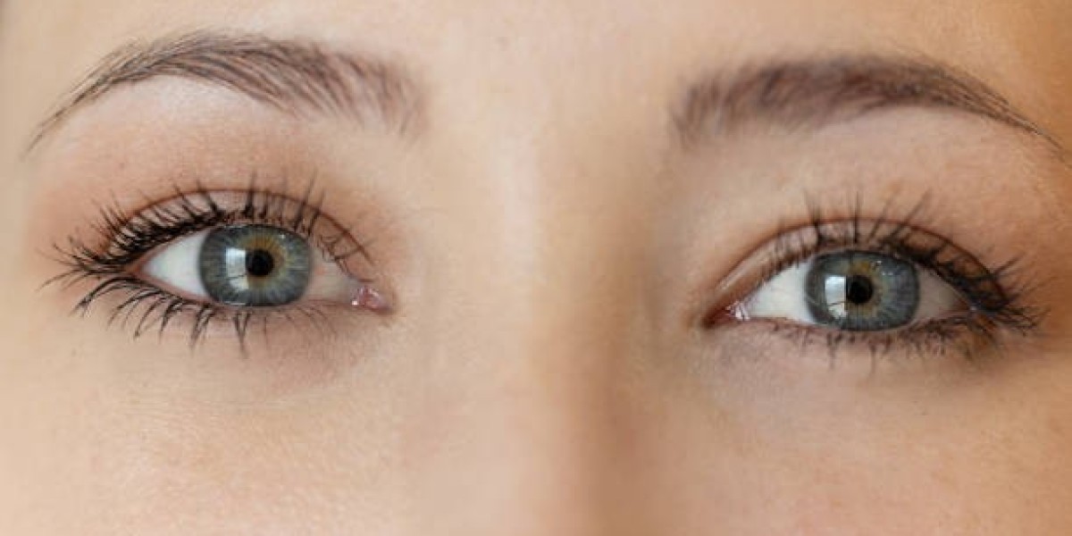 Best Practices for Blepharoplasty Aftercare and Healing