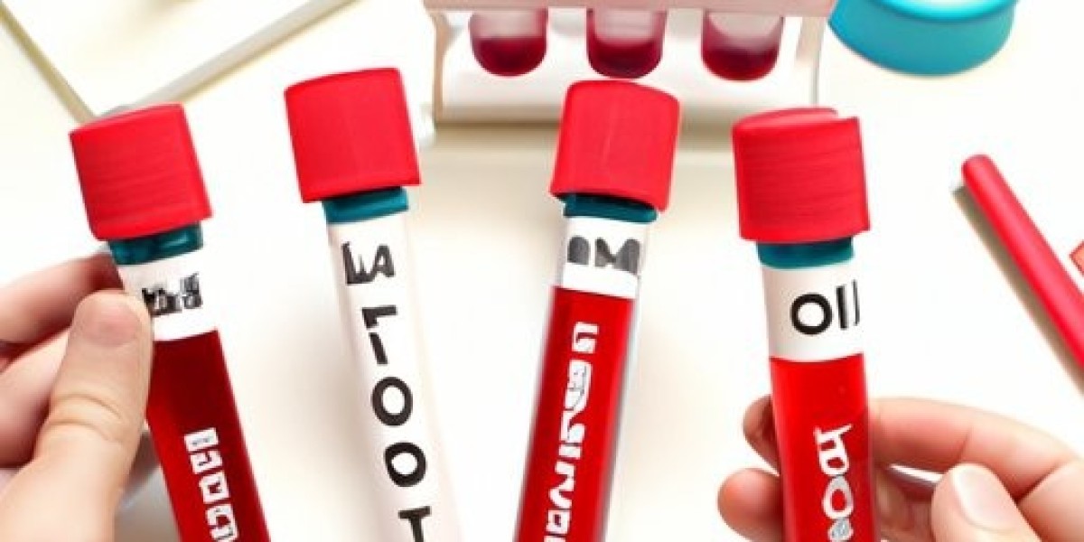 Blood Culture Tests Market Forecast 2023-2033: Trends, Drivers & Key Challenges
