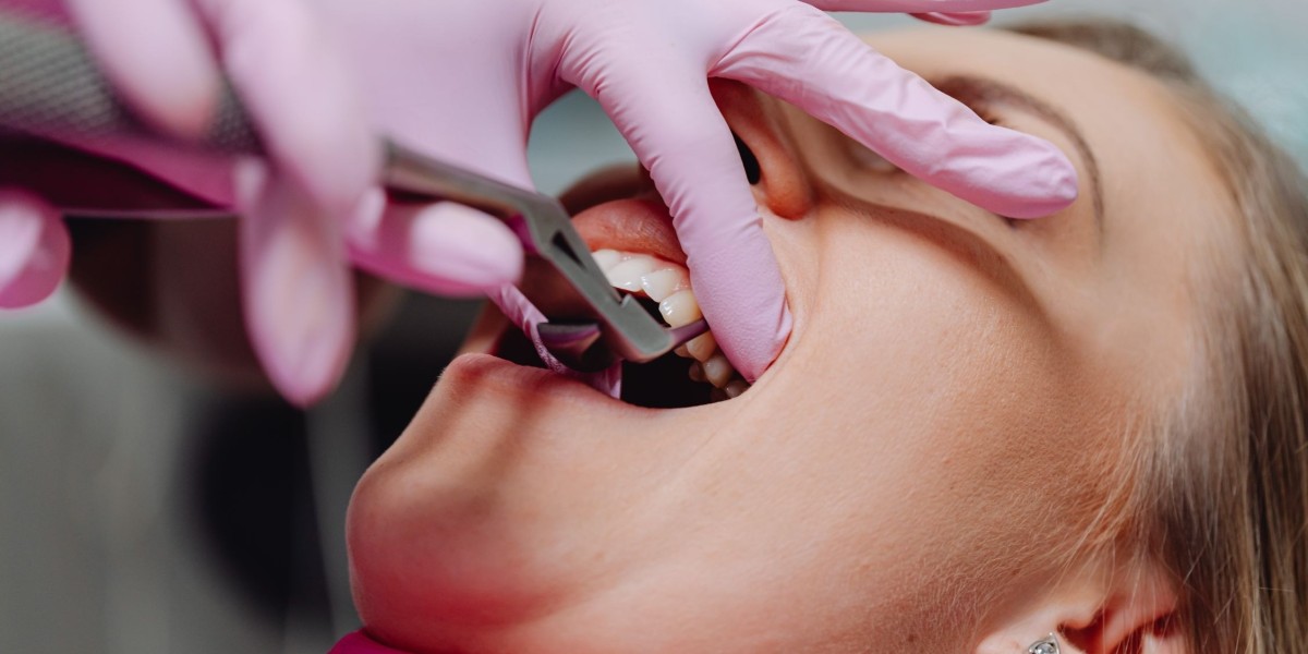 What Impacts Tooth Extraction Cost in Dubai?