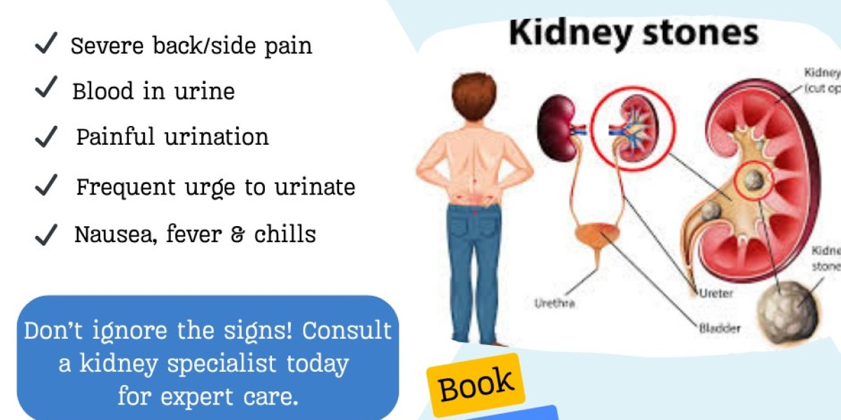 When to See a Doctor for Kidney Stones: Warning Signs to Act On