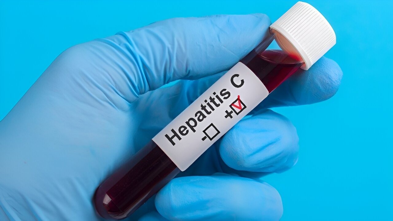 Hepatitis C Test