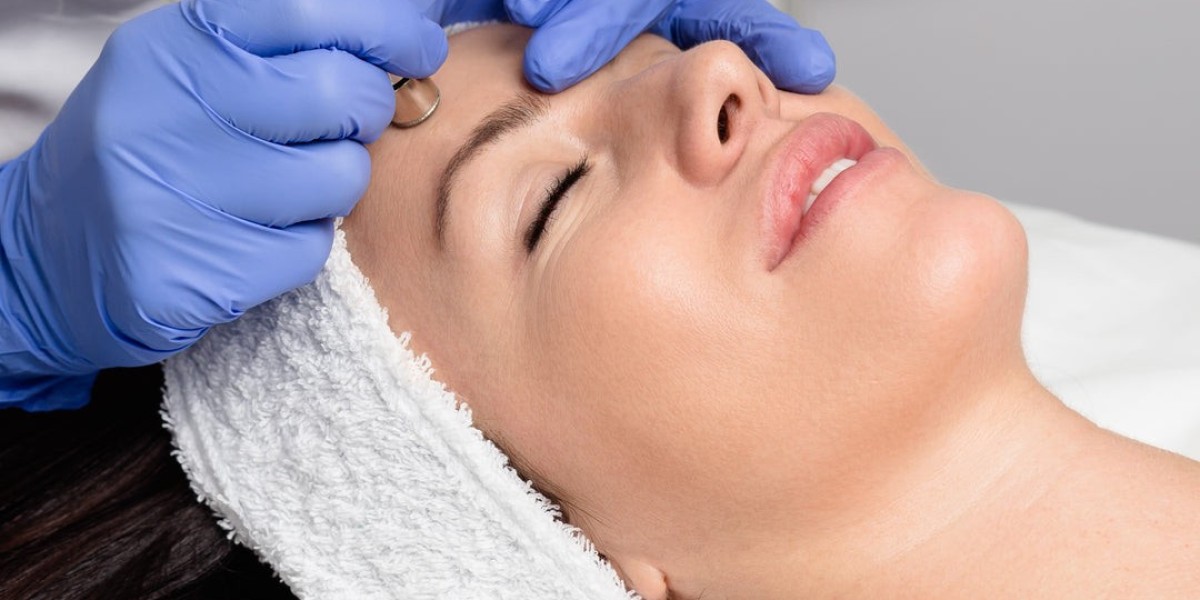 Can Diamond Peels Remove Acne Marks and Scars Effectively?