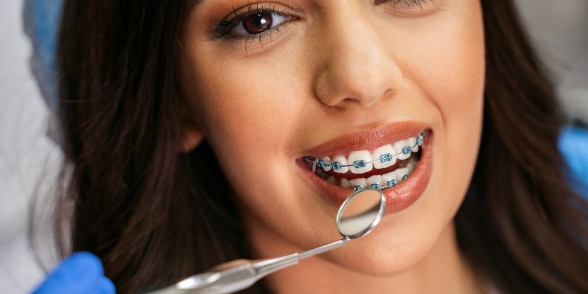 Common Problems with Braces and How to Fix Them