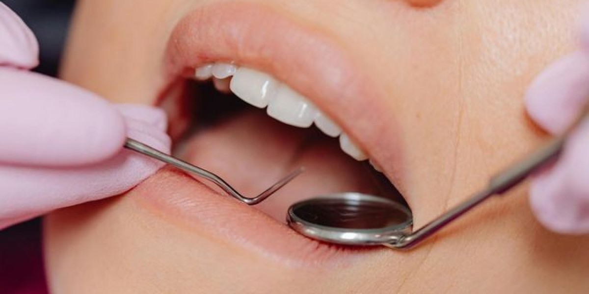Impacted Wisdom Teeth: Why Early Removal Matters
