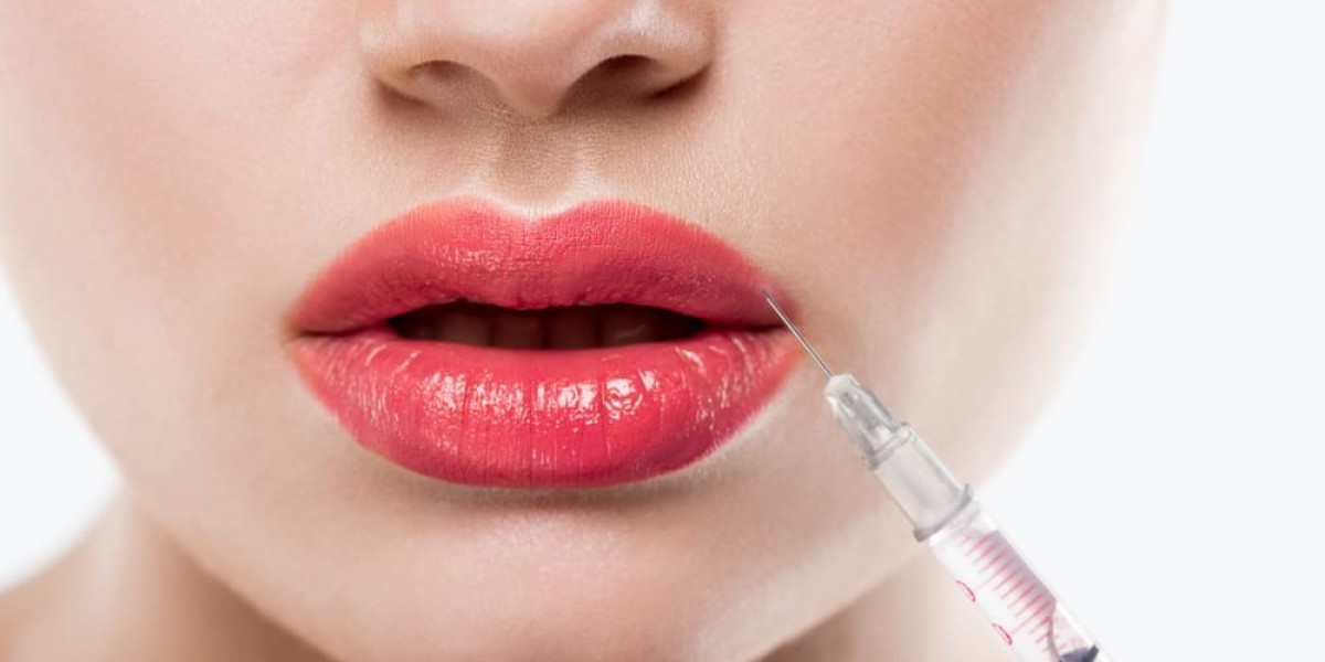 How Lip Fillers Injections Work: A Simple Guide for Beginners