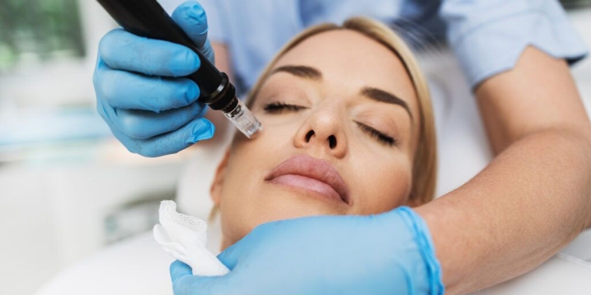 Is Microneedling Beneficial for People with Oily Skin?