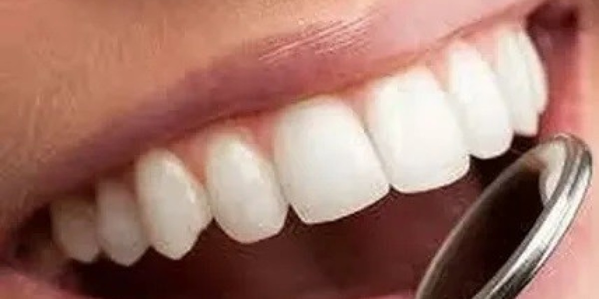 Best Age for Getting a Dental Crown in Islamabad