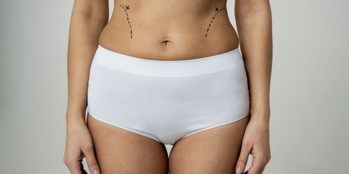 Can a Tummy Tuck Improve Body Shape?
