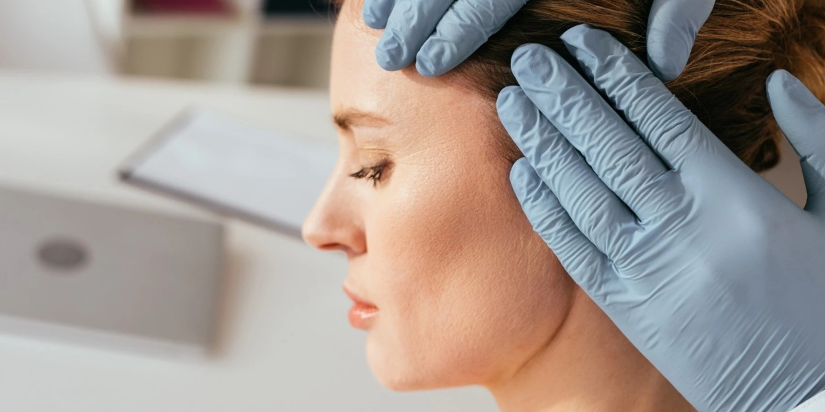 How Does Hair Transplant Improve Overall Hair Volume Naturally?