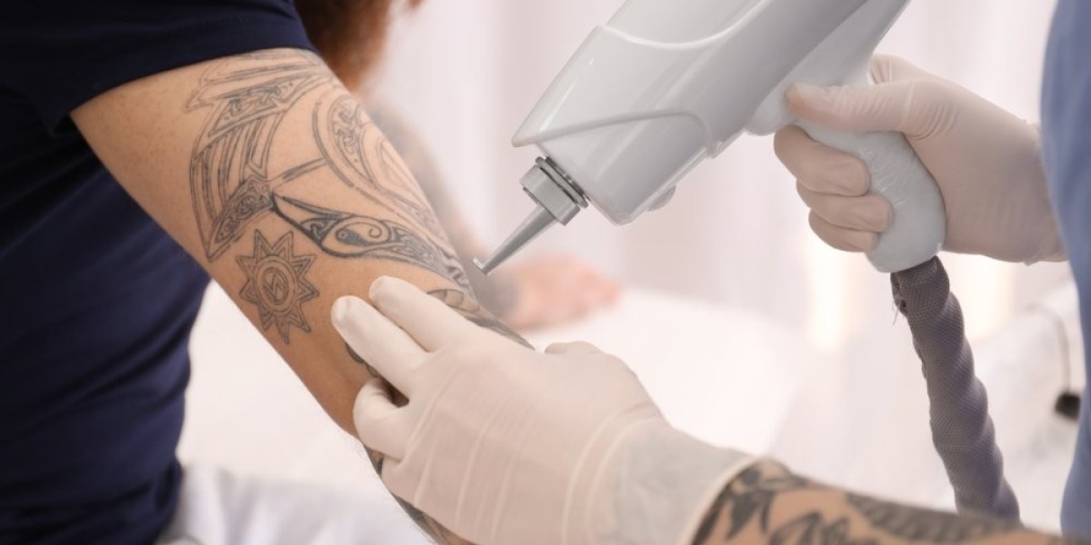 Tattoo Removal Safety: Clinics, Certifications & Patients’ Rights in Islamabad
