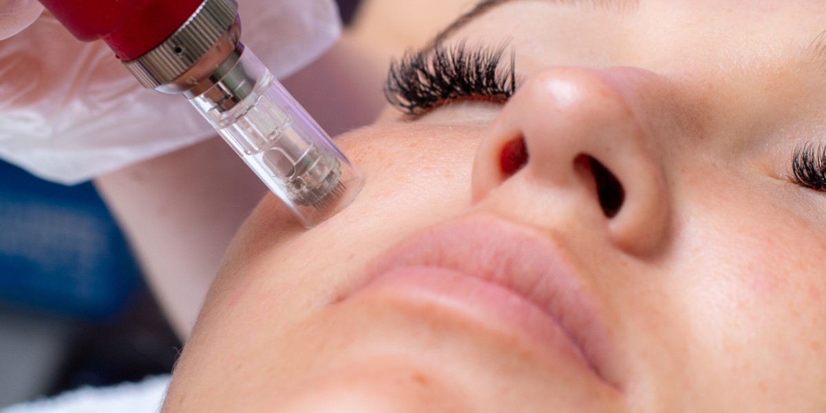 Is Microneedling Suitable for Every Skin Type?