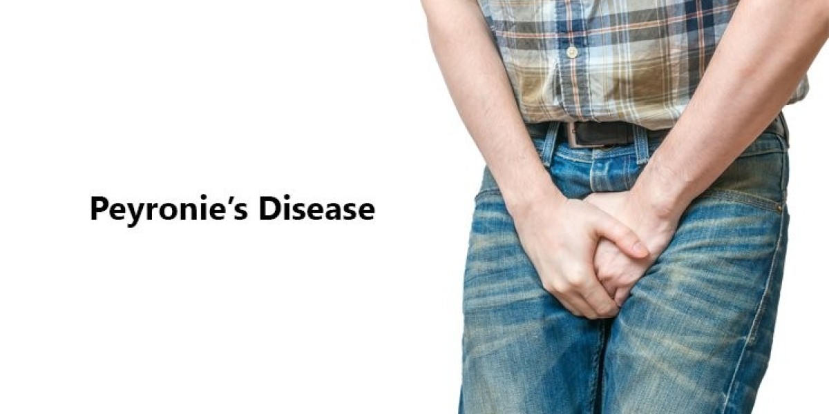 Peyronie’s Disease Treatment Guide: Causes, Symptoms & Solutions