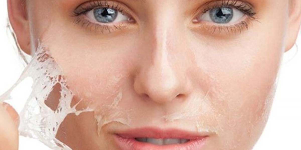How Often Should You Get Chemical Peels in Dubai for Optimal Results?