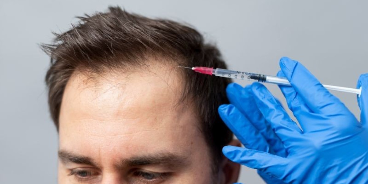 Glamorous Clinic in Dubai – Transparent Pricing for GFC Hair Treatment