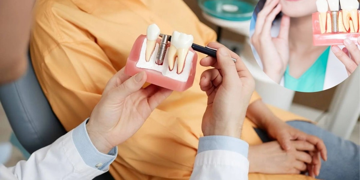 Smile Confidently Again Why Dental Implants Are the Best Choice for Missing Teeth
