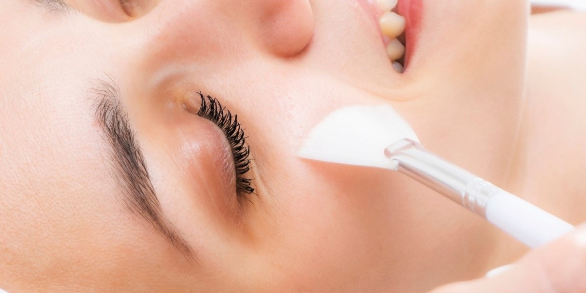 Why Chemical Peels Are Popular for Post-Summer Skin Care in Islamabad