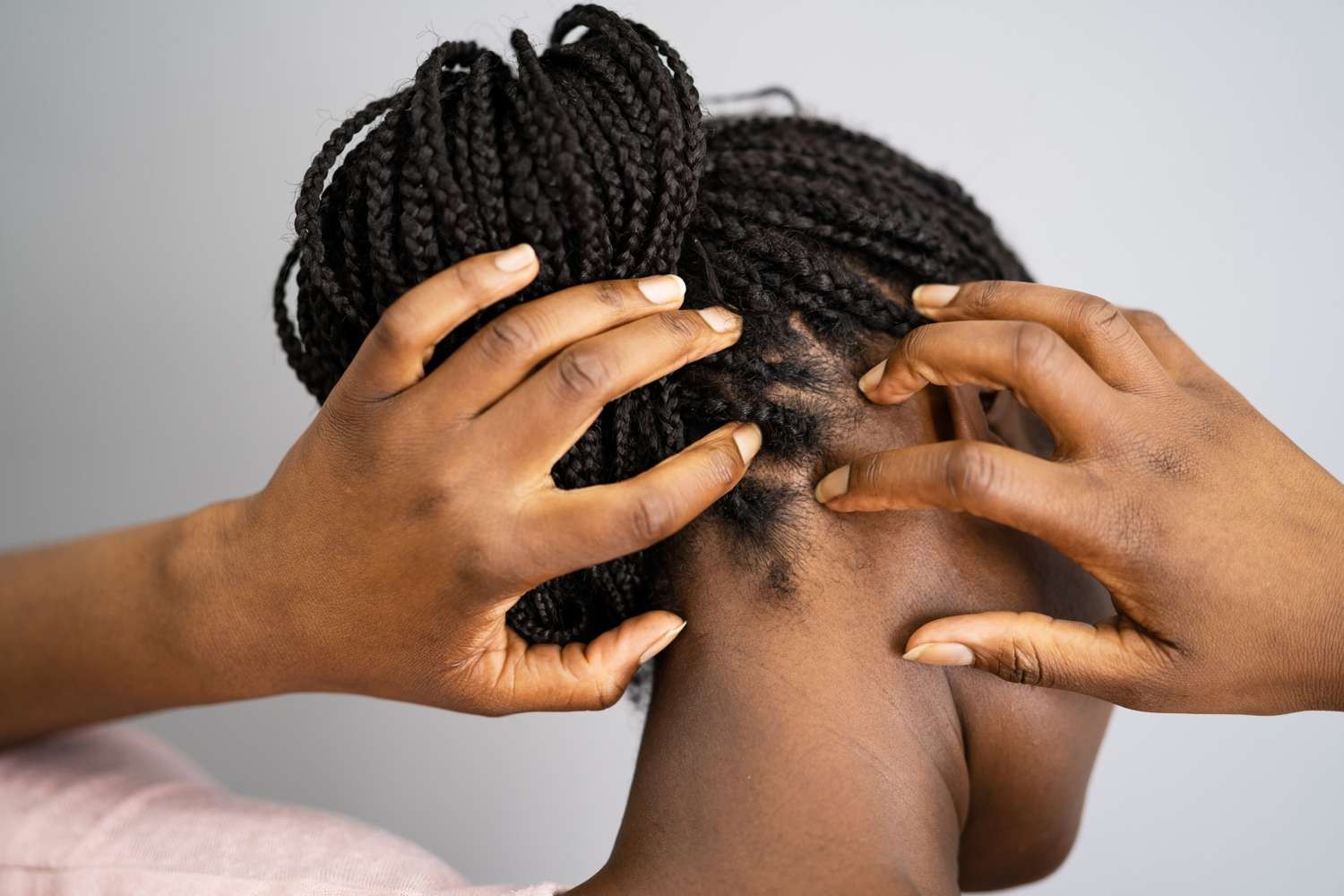 tingling sensation on scalp