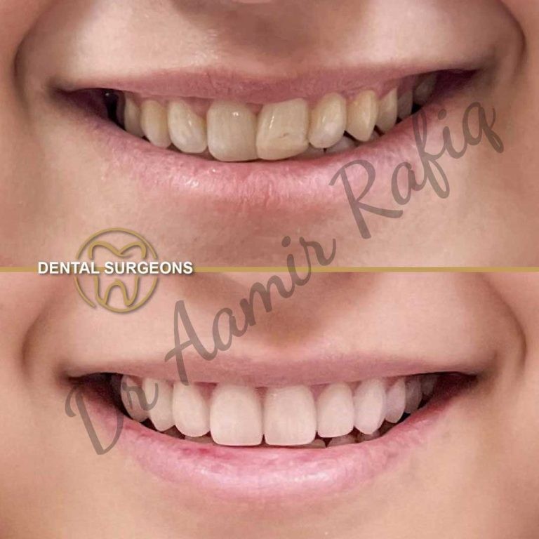 Dental Surgeons Pakistan – Expert Dental Care & Treatments