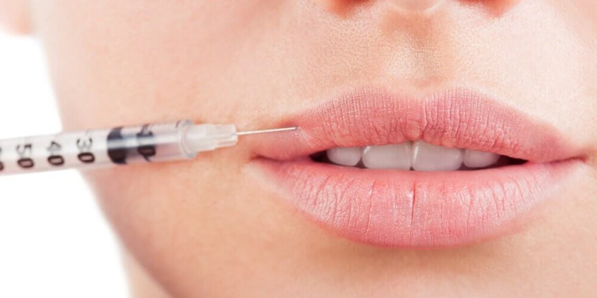 How Are the Best Lip Fillers Different From Standard Options?