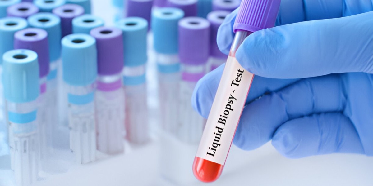 Top Five Liquid Biopsy Companies Driving Advances in Cancer Diagnostics from 2020 to 2028