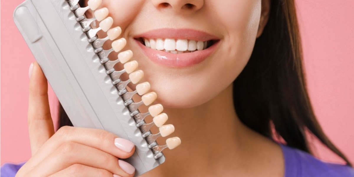 Are Dental Veneers Reversible? Understanding the Facts