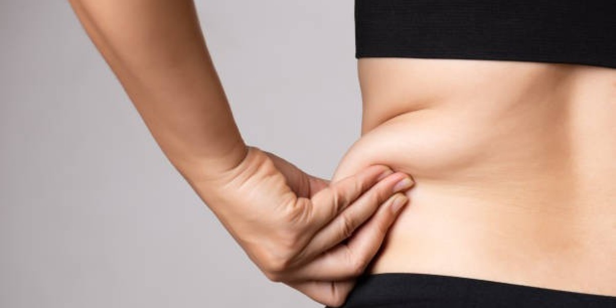Liposuction in Riyadh: Surgery Preparation Guide