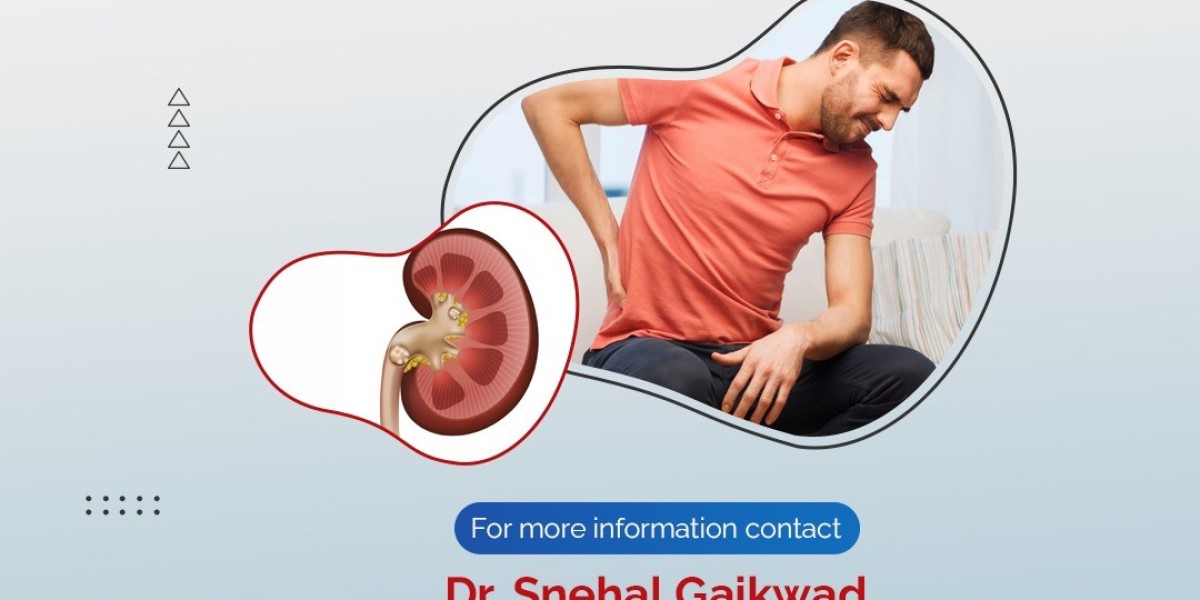 Understanding Kidney Stones: Signs You Shouldn’t Ignore