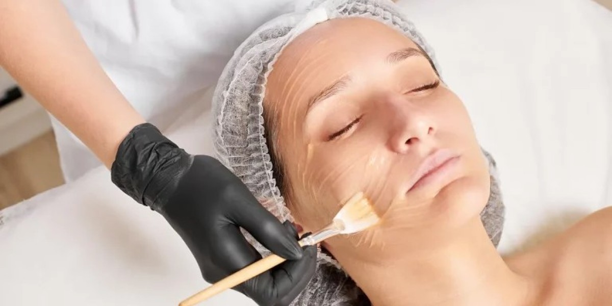 Do Chemical Peels Help Minimize Wrinkles?