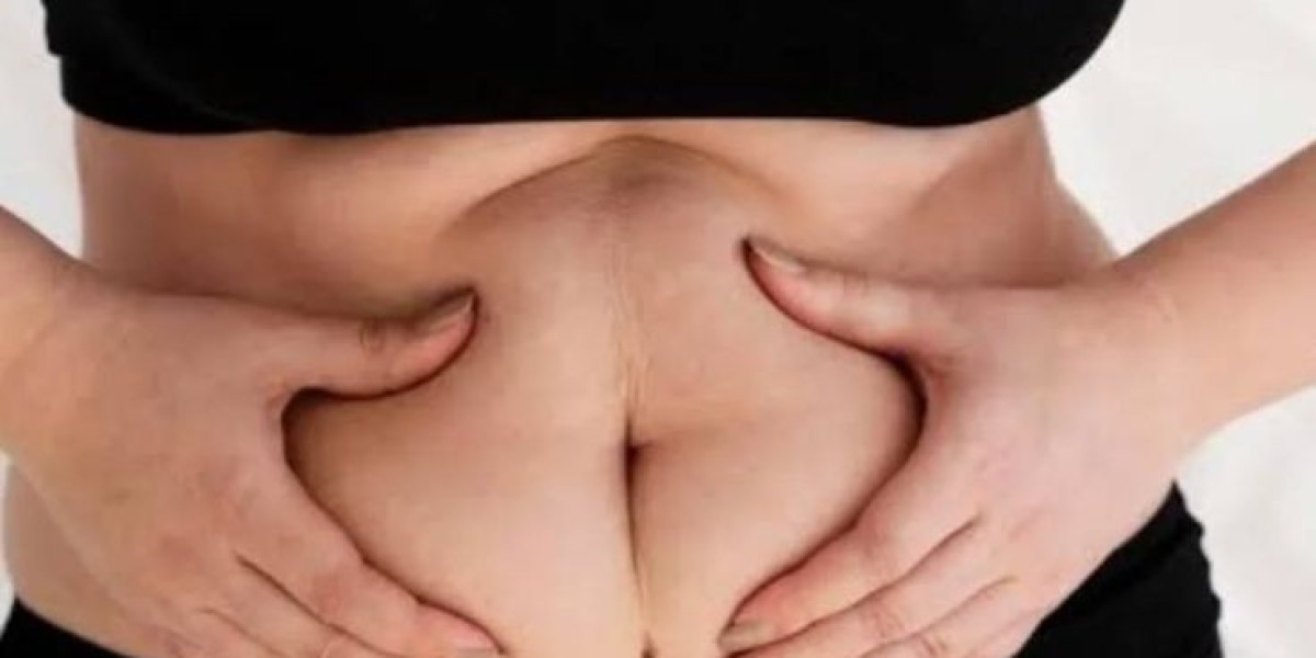 Laser Liposuction Risks and Complications in Riyadh: What You Should Know